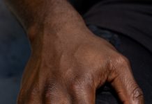 When Knees knock: Many Are Ignorant About Osteoarthritis