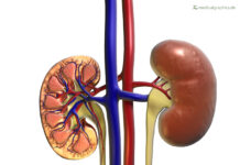 World Kidney Day: Knowing Your Kidney’s Health