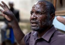 Tattoo Parlors and Sexual Activities Linked to Rising Mpox Cases: WHO Urges Immediate Vaccination and Public Health Measures