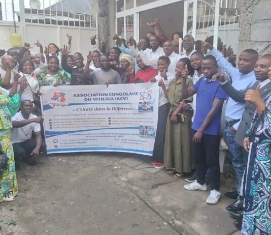 Goma to Host World Vitiligo Day 2026: A Global Call to Action