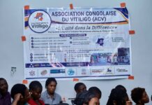In Goma, Congolese Vitiligo Patients Turn Stigma Into a Rallying Cry for Change