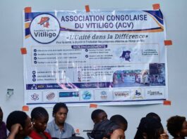 In Goma, Congolese Vitiligo Patients Turn Stigma Into a Rallying Cry for Change