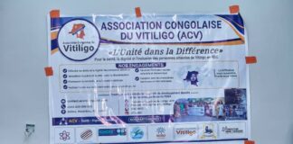 In Goma, Congolese Vitiligo Patients Turn Stigma Into a Rallying Cry for Change